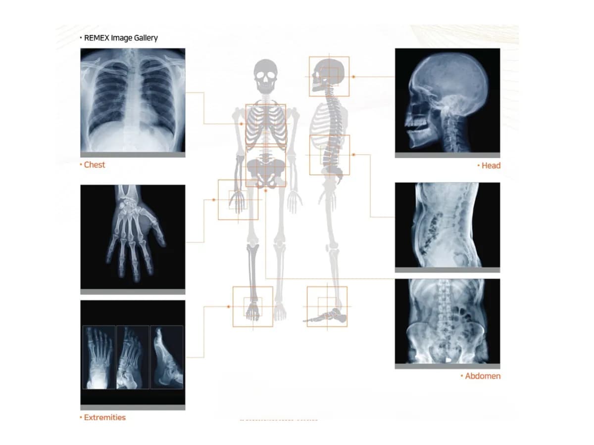 Sample radiographs: chest, hand, skull, spine and extremities