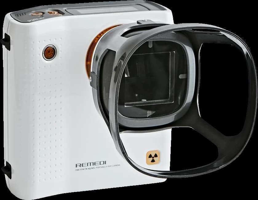 Remescan REMEX-KA6 handheld X-ray (image courtesy Remescan)